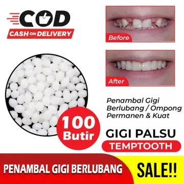 Jual Temptooth Temp Tooth Lem Gigi Palsu Bahan Tambal Temporary