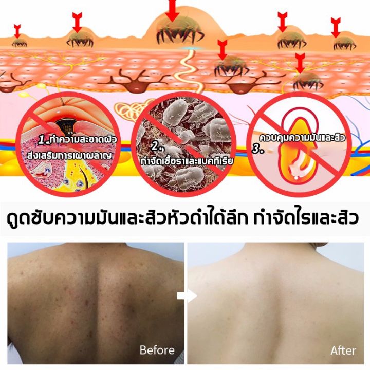 roushun-สบู่วิตามิน-ค-สูตรเพิ่มวิตามินซี-สบู่ขาวสีส้ม-ครีมขาวเร่งขาว-สบู่ไวท์เทนนิ่ง-ช่วยทำความสะอาดใบหน้าและร่างกาย-สบู่เร่งผิวขาว-ข