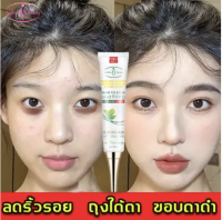 Aichun ครีมบำรุงใต้ตา ครีมบำรุงตา 30ml (ครีมใต้ตา เซรั่มทาถุงใต้ตา ครีมแก้ขอบตาดำ าดำครีมทารอบดวงตา เซรั่มอายครีม ครีมทารอบดวงตา เม็ดไขมัน ให้ความชุ่มชื่น ครีมบำรุงรอบตา）