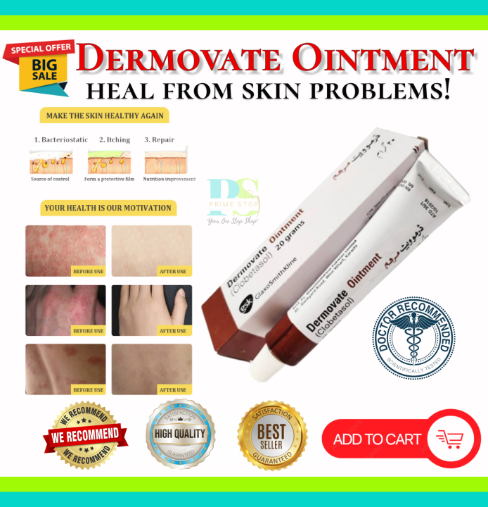 Dermovate Ointment 20G | Lazada PH