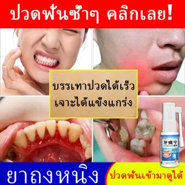 ปวดรากฟัน ราคาถูก ซื้อออนไลน์ที่ - ก.ย. 2023 | Lazada.Co.Th