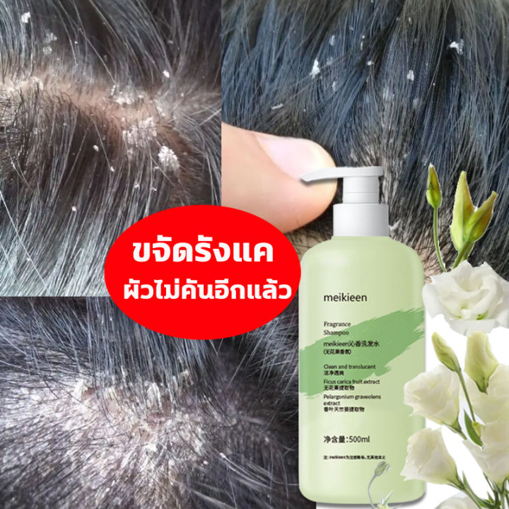 oushila-ไรฝุ่น-ยาสระผมเชื้อรา-500ml-แชมพูขจัดรังแค-ผมเรียบ-บรรเทาอาการคันหนังศีรษะ-แชมพูมะเดื่อ-แชมพูสมุนไพรยาสระผม-ยาสระผมรังแค-แชมพูแก้เชื้อรา-แชมพูรักษารังแค-ยาสระผมขจัดรังแค-ดูแลหนังศีรษะ-ยาสระผมแ