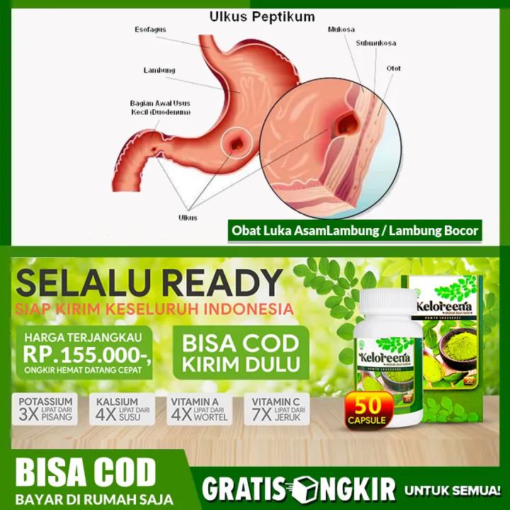 Obat Asam Lambung - Obat Infeksi Lambung - Obat Luka Lambung - Obat ...