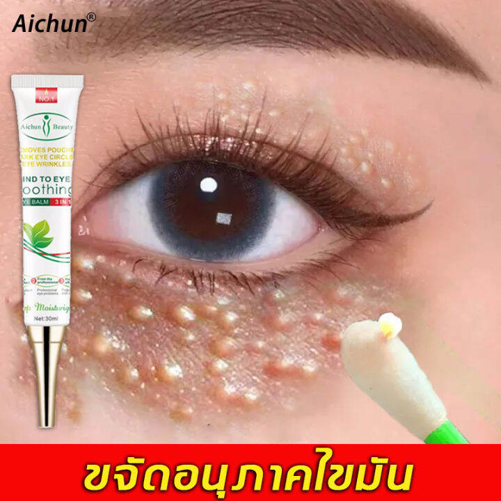 【ขายร้อน】aichun ครีมบำรุงตา ครีมบำรุงรอบตา กำจัดถุงใต้ตา 30ml ปรับปรุงอนุภาคไขมันและฟื้นฟูผิวรอบ