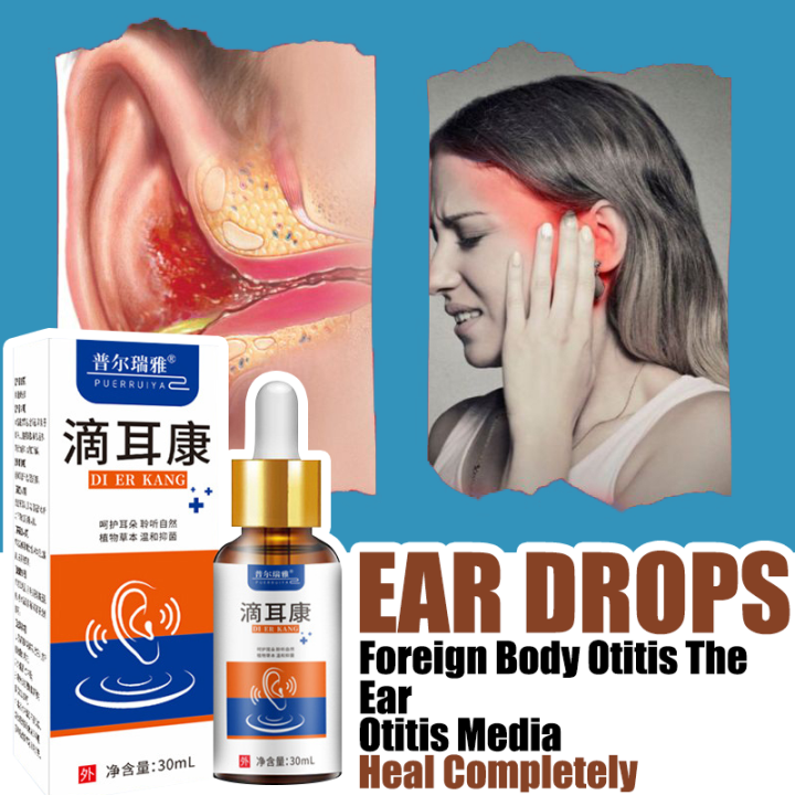 Non Irritating Otitis Media Ear Drops 30 Ml Otitis Media Softens Ear