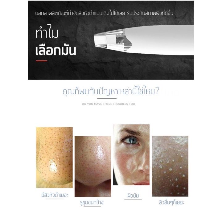 ดูดสิว-เครื่องดูดสิว-ดูดสิวเสี้ยน-สิว-สิวเสี้ยน-สิวและจุดด่างดำ-รูขุมขน-ผิวมัน-ผิวไม่สม่ำเสมอ-ไม่ทำร้ายผิว-ดูดสิวแบบ3d