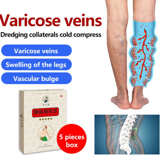 Cologo Varicose Vein Patch cold compress health stickers Lazada PH