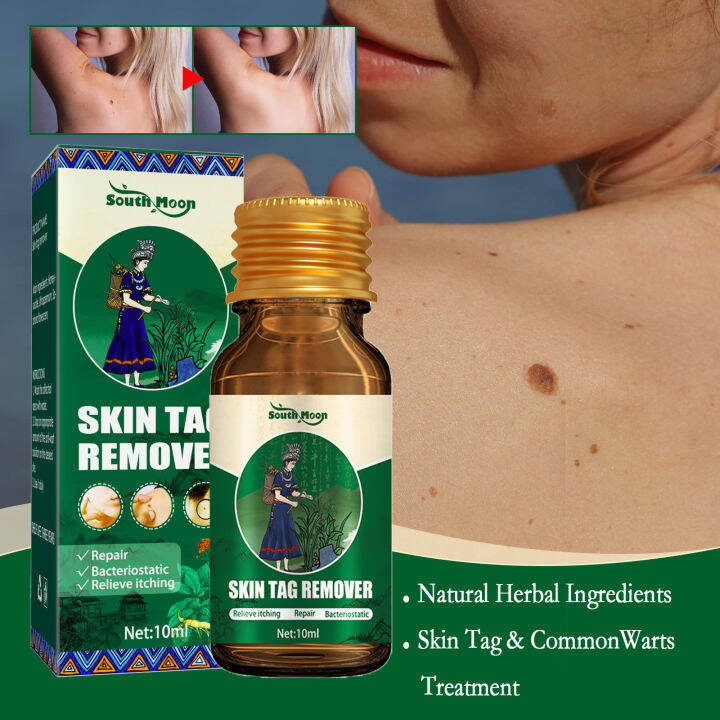 Skin Tag Remover Kill Skin Tag Mole Genital Wart Remover Skin Problem