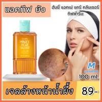 ส่งฟรี ที่ล้างหน้า โฟม สบู่ เจลน้ำผึ้งล้างหน้า  กิฟฟารีน แอคทีฟ ยัง แอคเน่ย์ แคร์ คลีนเซอร์  เจลล้างหน้า โฟมล้างหน้า