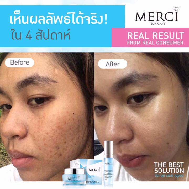 สินค้าแท้-100-ลดสิว-ลดผื่นได้ดี-merci-sleeping-maskii-30g-เมอร์ซี่-สลิปปิ้ง-มาส์ค-ทู-ครีมมาส์คหน้าขาวกระจ่างใส-ช่วยลดสิวผดผื่นบนใบหน้า