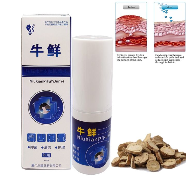 uclanka-pure-skin-psoriasi-spray-for-of-and-skin-whitening-spray