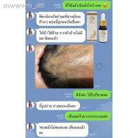 ?สินค้าขายดี? [3ขวด,30ml]รุ่นล่าสุดของปี 2021 รับประกัน 100 % ต้นฉบับ▤✱❐เซรั่มปลูกผมปลูกผม ปลูกคิ้ว ปลูกหนวด แก้ผมร่วง เห็นผลชัดเจนตั้งแต่ขวดแรก