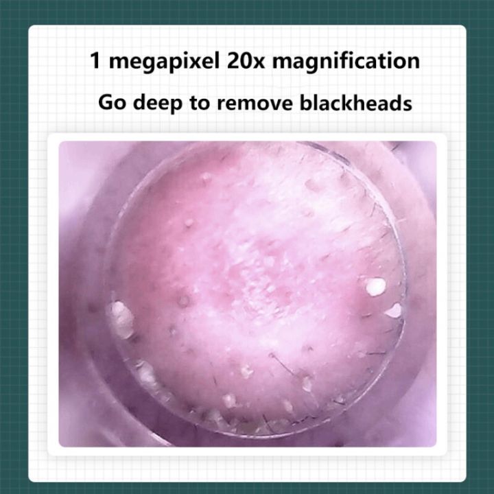 app-visual-blackhead-remover-with-hd-camera-20x-magnification-pore-ance-cleansing-vacuum-suction-wifi-connection-beauty-device