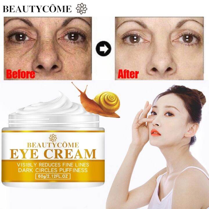 Snail Eye Cream Anti Wrinkle Dark Circle Eye Bag Fade Fine