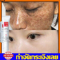 【ดูกระจ่างผิวใส】EL จุดด่างดำ ครีมลดฝ้ากระ ครีมกน้าขาวใส 20g ลดฝ้ากระที่ฝังลึก ครีมทาฝ้าหนาๆ คลีมรักษาฝ้ ทาฝ้าหนาลึก ครีมทาฝ้าหนาๆๆ ครีมทาผิวกระ ครีมทาหน้าขาว ครีมแก้ฝ้า ครีมทาฝ้ากระ ครีมแก้ฝ้าแท้ๆ ครีมทาฝ้า โฟล้างหน้าขาว