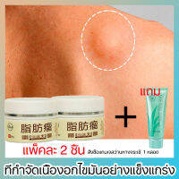 【แพ็คละ 2 ชิ้น】 ครีมทาเนื้องอกไขมัน 30g สลายก้อนเนื้อใต้ผิวหนัง กำจัดก้อนเนื้อแข็ง ปลอดภัยไม่เจ็บ กำจัดรวดเร็ว