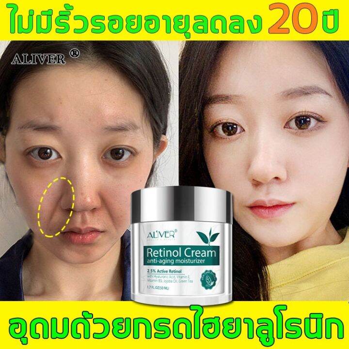 รุ่นขายดี] Aliver ครีมลบริ้วรอย 50G ลดรอยตีนกา ร่องแก้ม ริ้วรอยหน้าผาก  ขจัดความหมองคล้ำ ยกกระชับ ทำให้ผิวเรียบเนียนยืดหยุ่น (ครีมลดริ้วรอย ครีมหน้าขาวใส  ครีมต่อต้านริ้วรอย รีมลบริ้วรอย ครีมริ้วรอย ครีมทารอบดวงตา ครีมหน้าขาว ）  Anti-Wrinkle Cream ...