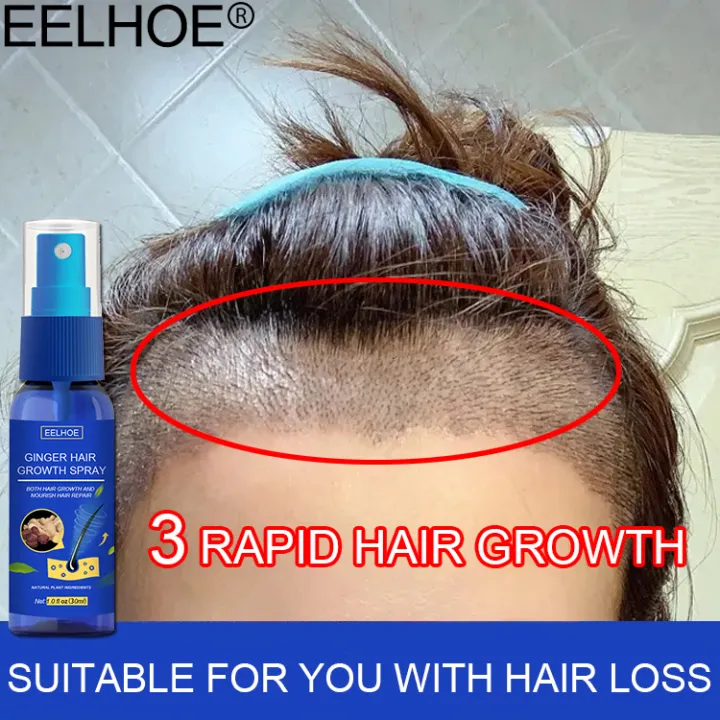 7 days to grow new hair🔥EELHOE hair growth spray Fast Powerful prevents hair  loss