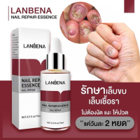 ของแท้ 100% LANBENA เซรั่มบำรุงเล็บ น้ำยาบำรุงเล็บ บำรุงเล็บ ต่อต้านการติตเชื้อรา ซ่อมแซมเล็บแตก เล็บเปราะ เล็บหนา