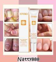 ( ของแท้ / พร้อมส่ง ) Efero การรักษาเล็บเชื้อรา Feet Care Essence Whitening เล็บเท้ากำจัดเชื้อราเจลป้องกันการติดเชื้อ Onychomycosis เล็บ Repair Essence