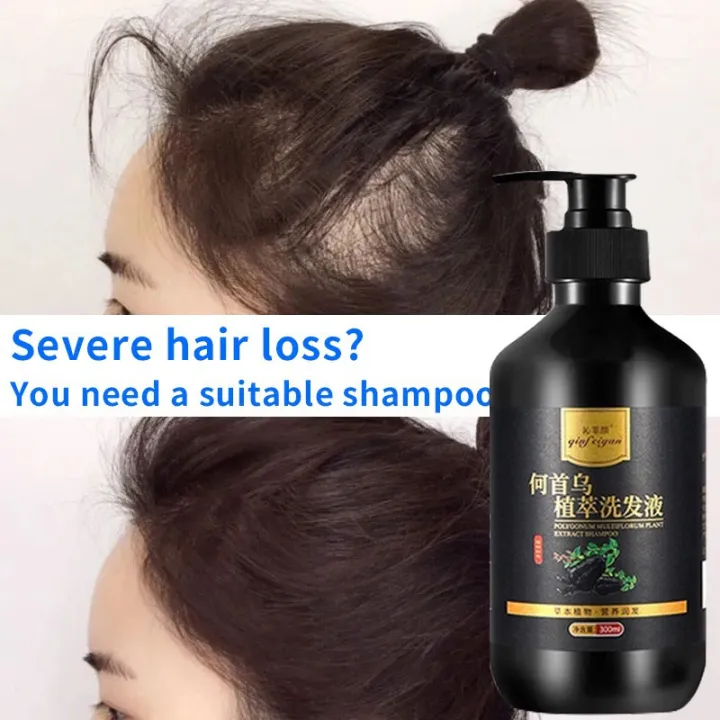 Pure natural Polygonum multiflorum herbal essence shampoo 300ml