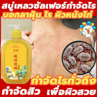 TANYA ครีมอาบน้ำหอมๆ 408ml สบู่อาบน้ำ ครีมอาบน้ำ สบู่เหลว ครีมอาบน้ำเด็ก ครีมอาบนำ้า เจลอาบน้ำ กำจัดไร ครีมอาบน้ำตัวหอม ยังใช้ได้ทั้งเด็กและคนท้อง โฟมเยอะ อ่อนโยนไม่ระคายเคือง ล้างให้มีผิวสวยใสไร้สิวออกมา บอกลาผิวหยาบกร้าน shower gel