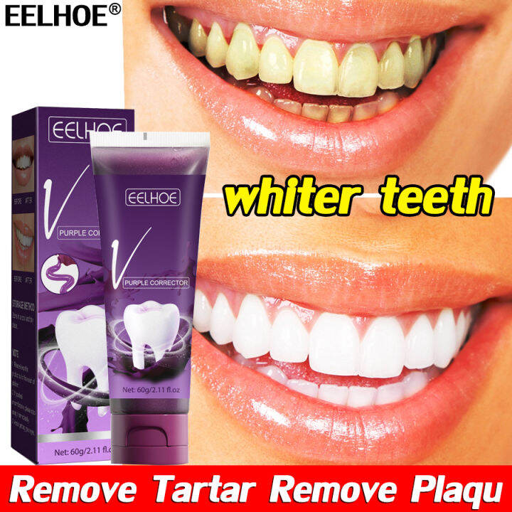 turn white in 3 days LANTHOME Teeth Whitening Oral Hygiene Remove ...