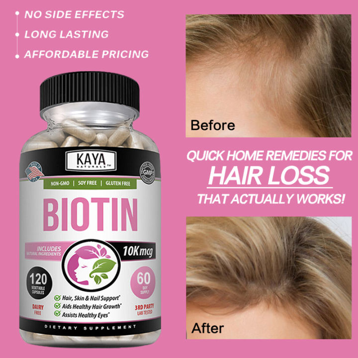 Shengfa capsule pure biotin promotes healthy hair growth without side  effects | Lazada