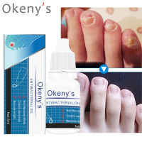 OkenyS Herb Fungal Nail Renewal Treatment Liquidเล็บเท้ากำจัดเชื้อราเจลBright Nail Repairป้องกันการติดเชื้อFeet Care Essence Antibacterialน้ำมัน5Ml