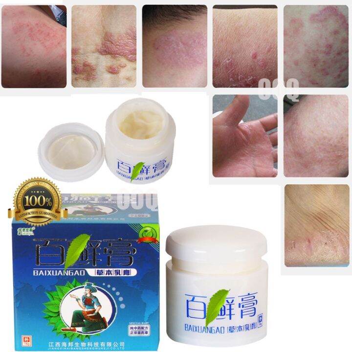 Herbal For PSORIASIS and ECZEMA BaiXuanGao Advance Natural Herbal