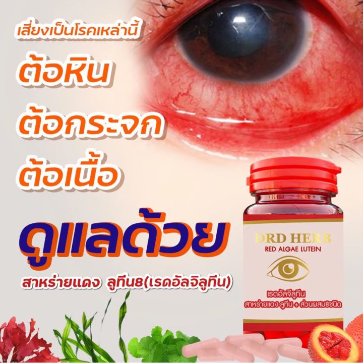 ต้อกระจก-ต้อลม-จอประสาทตาเสื่อม-เบาหวานขึ้นตา-หยากไหย่ในตา-1-กระปุก-ส่งฟรี-เรดอัลจีลูทีน-drd-herb-บำรุงสายตา-ลูทีน-ซีแซนทีน-สาหร่ายแดง