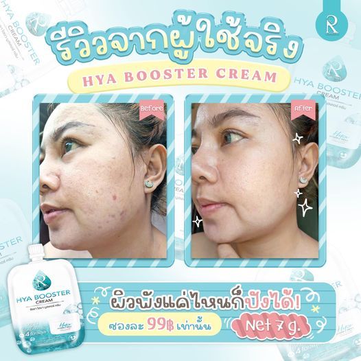 3ซอง-ครีม-ไฮยา-น้องฉัตร-hya-booster-cream-ผิวกระจ่างใส-ลดรอย-ดำ-รอยแดง-ผิวไหม้-แสบ-ผิวชุ่มชื้น-ขายดี-ใช้ดี-หน้าขาว-ผิวเด้ง