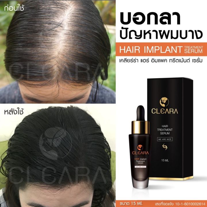 ส่งฟรี-cleara-สเปร์บำรุงรากผม-1-ขวด-บอกลาหัวล้าน-ผมบาง-ผมหนาขึ้น-บำรุงเส้นผม-รากผมแข็งแรงขึ้น-ลดการหลุดร่วง-50ml-เคลียร์ร่า