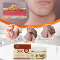 Lipoma cream Chinese herbal cream fat loaf cream Get rid of subcutaneous problems solid fat mass fatty tumors herbs to eliminate