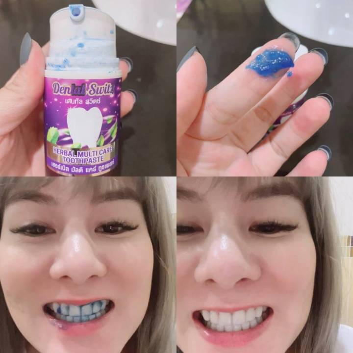 โปร-1-แถม-1-ยิ้มโชว์ฟันขาวอย่างมั่นใจแนะนำ-ยาสีฟัน-dental-switz-ลมหายใจหอม-ขจัดคราบชา-กาแฟ-คนจัดฟันใช้ได้