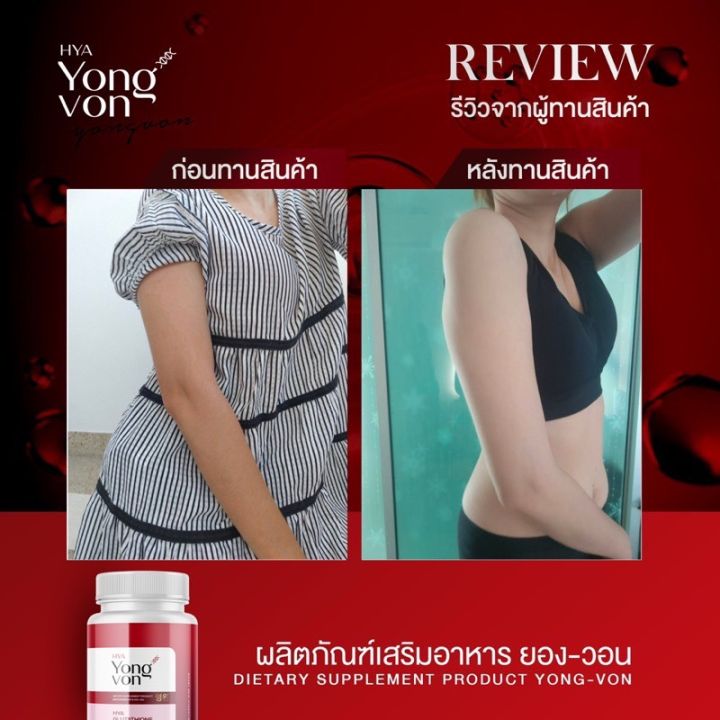 พร้อมส่ง-1-แถม-1-yong-von-วิตตามินซอฟเจลเกาหลี-ยองวอน-สูตรเข้มข้น-2-เท่า-แพคคู่-2-กระปุก-ปริมาณรวม-60-ซอฟเจล