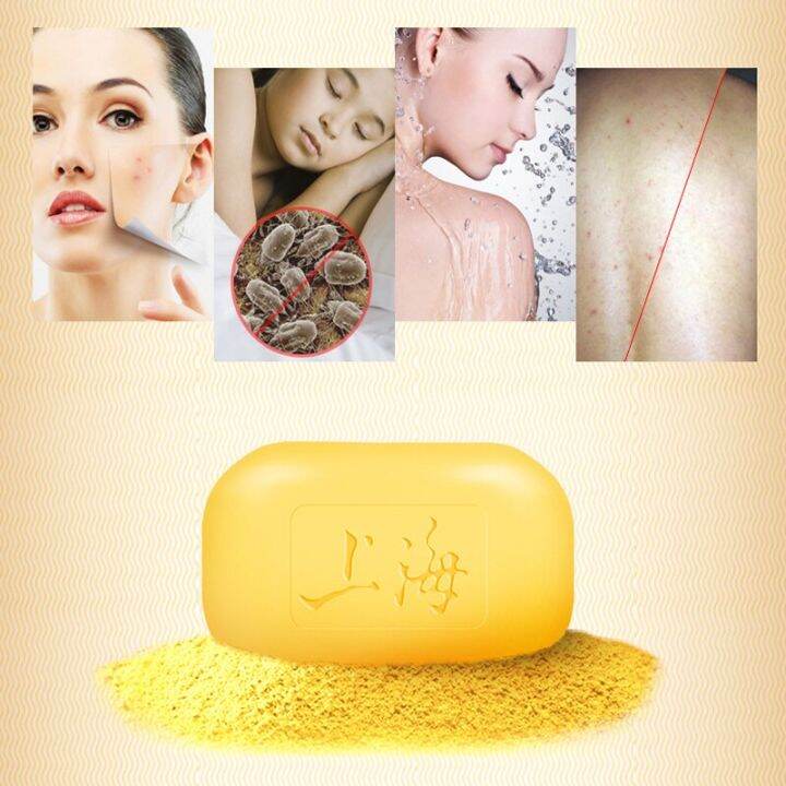 Shanghai Sulfur Soap Acne Psoriasis Seborrheic Eczema Antifungal Healthy Soaps Lazada