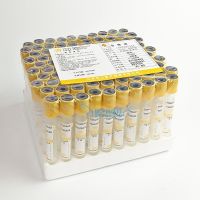 【LZ】◑✇  Tubo de coleta de sangue descartável do vácuo de 100 pces com gel da separação/tubo de coleta de sangue médico do laboratório do coagulante