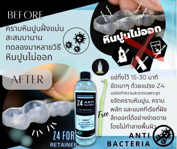 น้ำยาทำความสะอาดรีเทนเนอร์-และฟันปลอม-z4-anti-plaque-พร้อมแปรงเฉพาะจุด-z4-ปกติ-70-ขจัดคราบหินปูนพลัค-แบคทีเรียดีกว่าเม็ดฟู