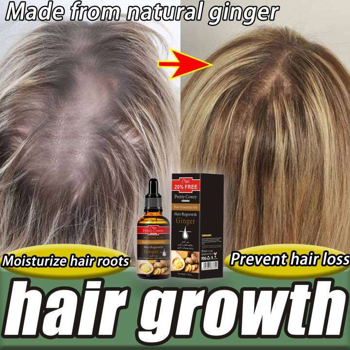 Prevent hair loss Pretty Cowry Ginger Hair Growth Essential Oil Hair