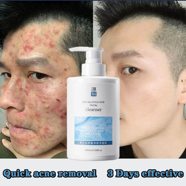 Acne Removing Facial Cleanser Oil Control and Acne Removing 500ml Men's Facial Cleanser