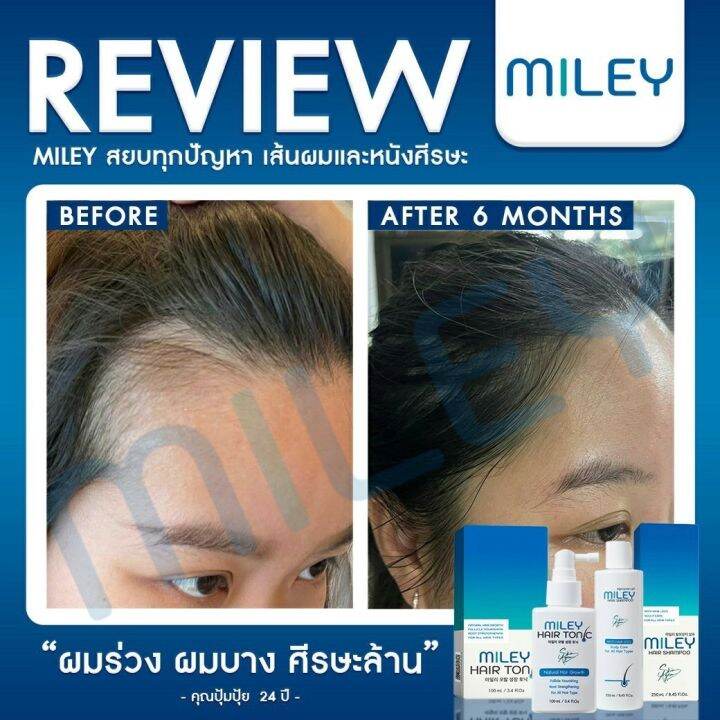 โปรโมชั่นใหม่-ซื้อมิลเล่-แฮร์-แชมพู-miley-hair-shampoo-miley-hair-tonic-1-ขวด-แถมฟรี-มิลเล่-แชมพู-30ml-2หลอด