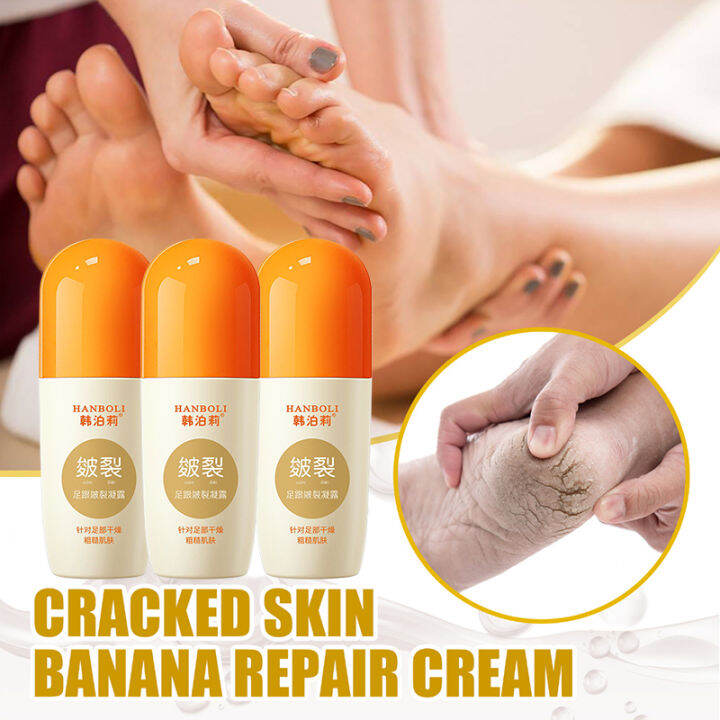 Original Foot Cream For Dry and Crack Heels Repairing Rough Calluses ...