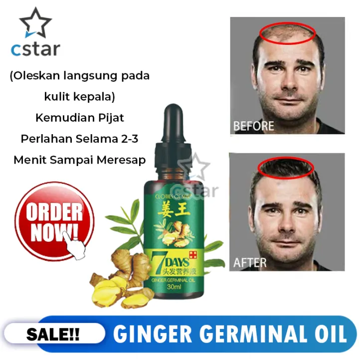 READY JKT!! Obat Serum Penumbuh Rambut Wanita Dan Pria Secara Cepat ...