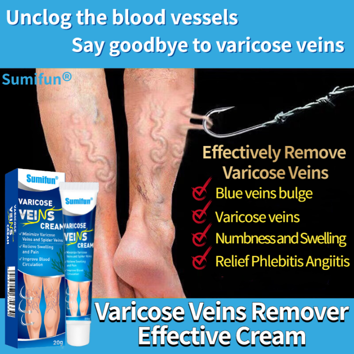 【Doctor Varicose Veins Remover Effective Cream 20g