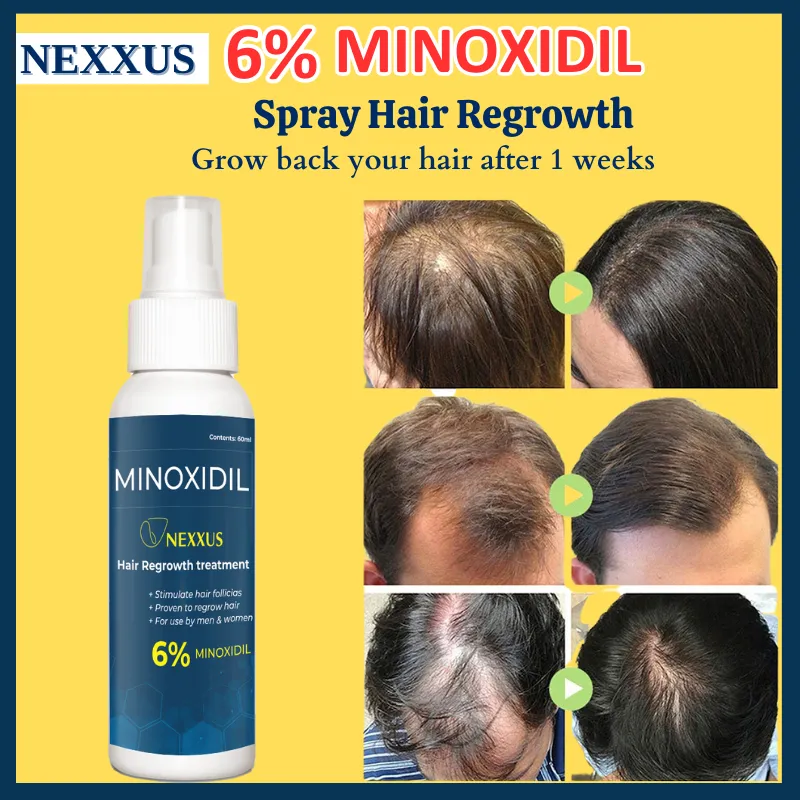 Top more than 149 hair growth spray minoxidil super hot - ceg.edu.vn