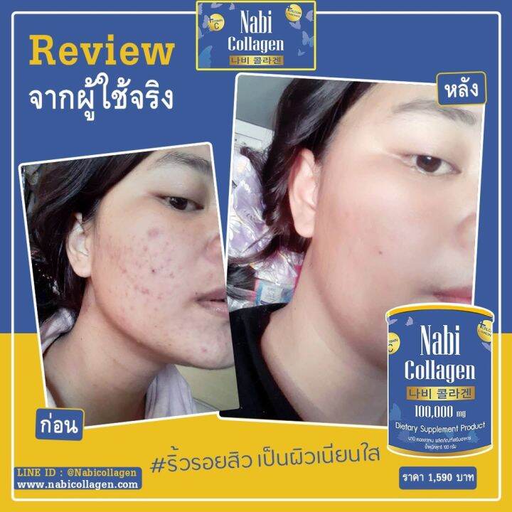 จัดส่งฟรี-2กระปุก-nabi-collagen-นาบี-คอลลาเจน-เกาหลี-บำรุงกระดูก-100-000-mg-คอลลาเจนผิวขาวใส-ข้อเข่าดี