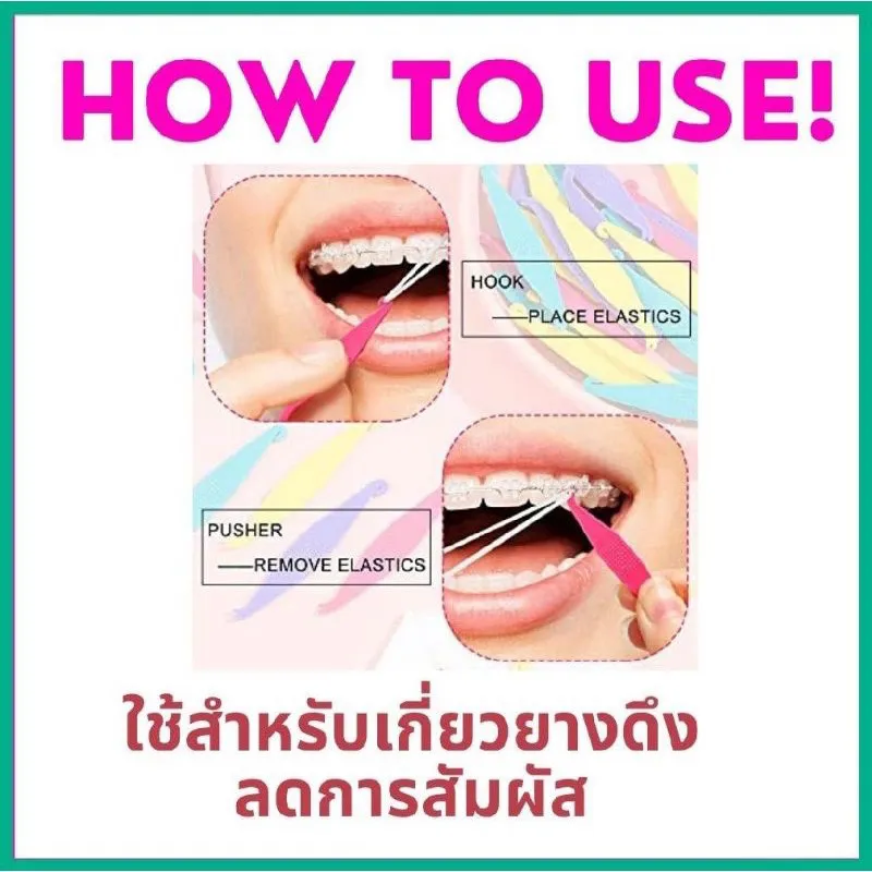 ที่เกี่ยวยางดึงฟัน สำหรับคนจัดฟัน | Lazada.Co.Th