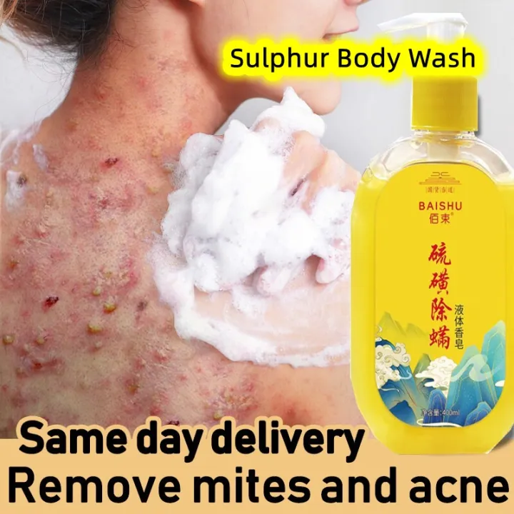 bath and body works shower gel back acne body wash sulfur soap sulphur