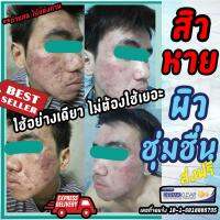 dermaspotklear 15.g สิว ดูแลสิว รอยสิว สิวสเตียรอยด์ พร้อมดูแลผิวให้ชุ่มชื่น ในหลอดเดียว เรื่องสิว ไม่ต้องใช้เยอะ หลักฐานมี รีวิวเพียบ